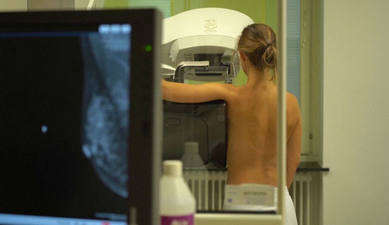 Detecci&oacute;n del c&aacute;ncer de mama