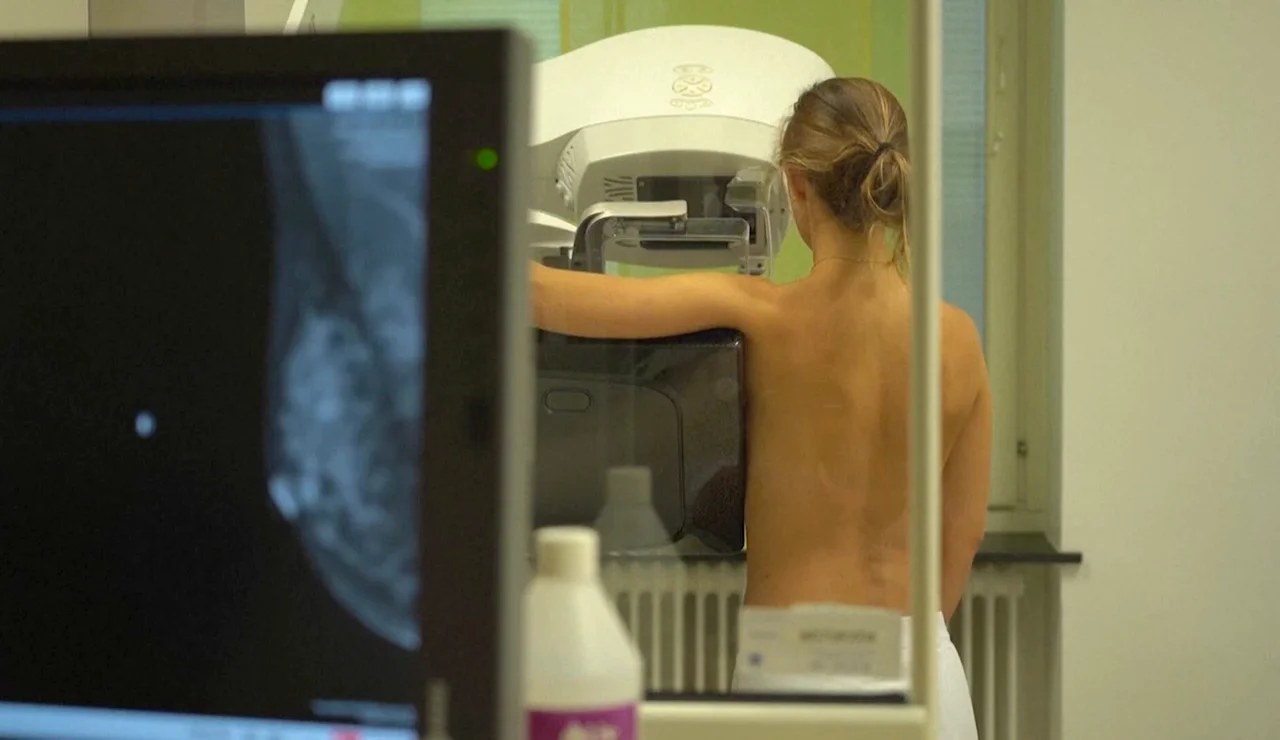 Detección del cáncer de mama