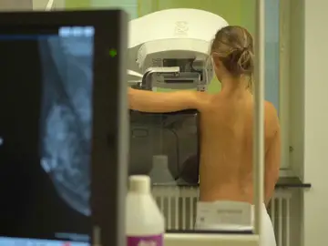 Detección del cáncer de mama Detección del cáncer de mama