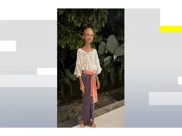 Muere la influencer Karolina Krzyżak por desnutrición tras seguir una dieta extrema de fruta cruda: pesaba solo 22 kilos Muere la influencer Karolina Krzyżak por desnutrición tras seguir una dieta extrema de fruta cruda: pesaba solo 22 kilos