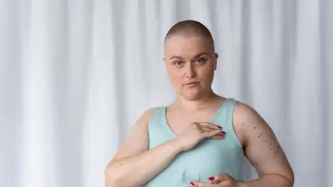 Mujer joven en lucha contra el cáncer de mama Mujer joven en lucha contra el cáncer de mama