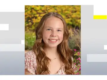 Recibe el alta la niña de 12 años que recibió un disparo en la cabeza en Estados Unidos Recibe el alta la niña de 12 años que recibió un disparo en la cabeza en Estados Unidos