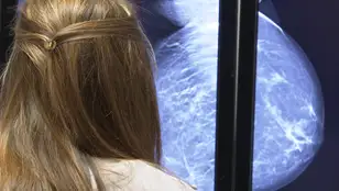 Diagnóstico cáncer de mama