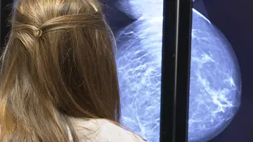 Diagnóstico cáncer de mama Diagnóstico cáncer de mama