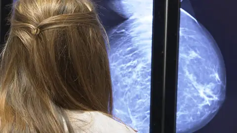 Diagnóstico cáncer de mama Diagnóstico cáncer de mama