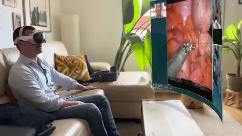 El hospital Germans Trias de Badalona ha realizado este hito durante una apendicitis agud El hospital Germans Trias de Badalona ha realizado este hito durante una apendicitis agud