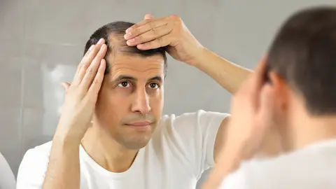 ¿Pensando en hacerte un implante capilar? ¿Pensando en hacerte un implante capilar?