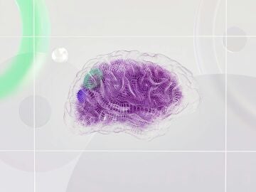 Imagen de un cerebro humano Imagen de un cerebro humano