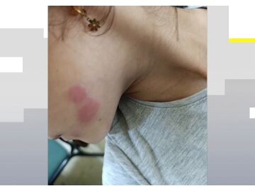 Una niña afectada Una niña afectada