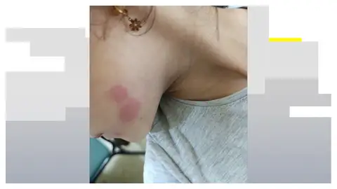 Una niña afectada Una niña afectada