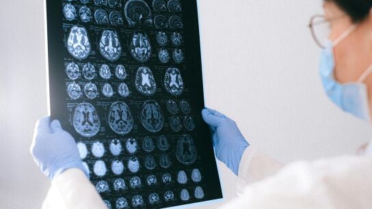 Resultados de esc&aacute;neres cerebrales