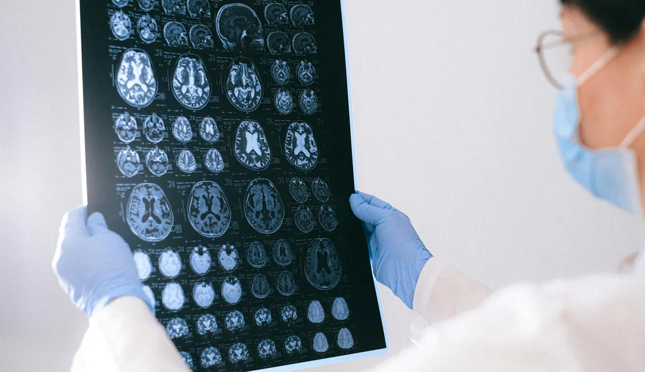 Resultados de escáneres cerebrales