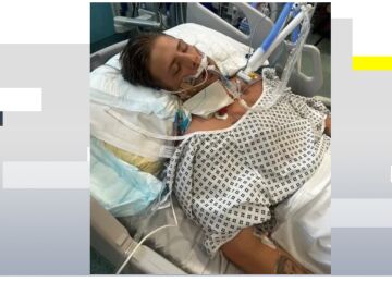 Un hombre podr&iacute;a morir despu&eacute;s de que los m&eacute;dicos confundieran un derrame cerebral con una borrachera