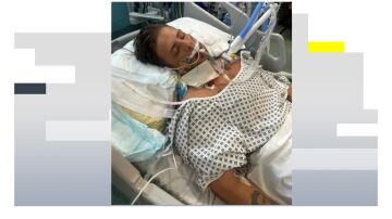 Un hombre podría morir después de que los médicos confundieran un derrame cerebral con una borrachera Un hombre podría morir después de que los médicos confundieran un derrame cerebral con una borrachera