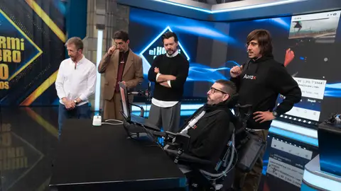 Odontología y tecnología unidas en un dispositivo único: Marron sorprende con un invento de pelicula Odontología y tecnología unidas en un dispositivo único: Marron sorprende con un invento de pelicula