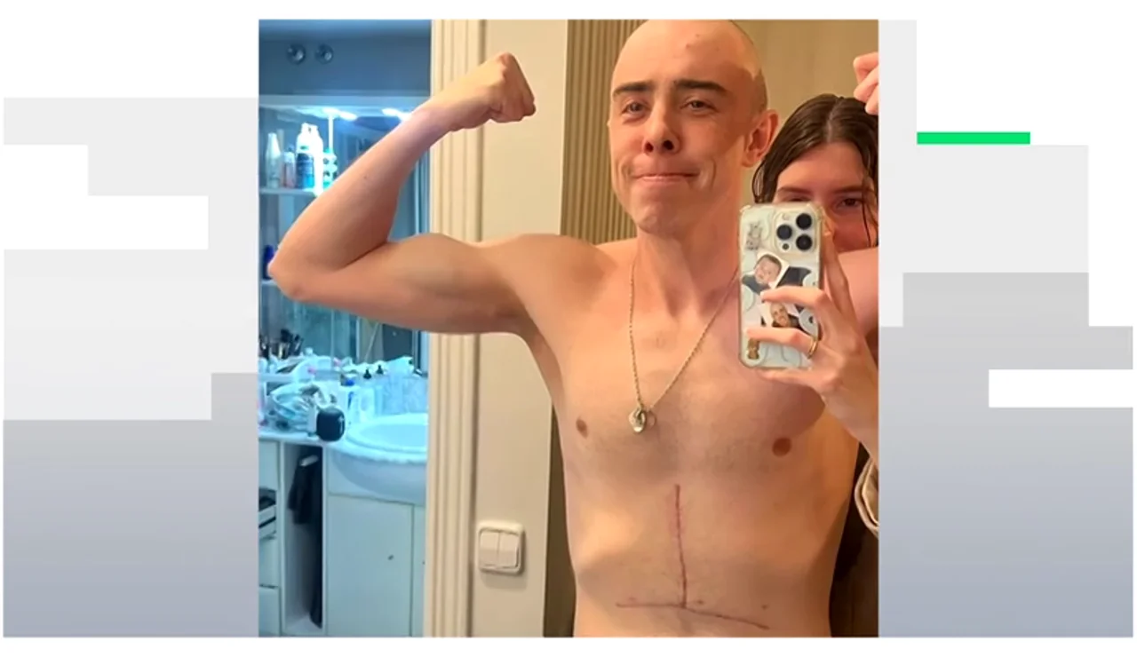 El triatleta que desafía lo imposible: Javier Corrales compite tras perder el 80% de su estómago