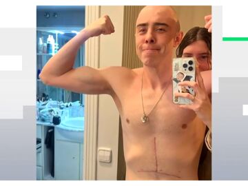 El triatleta que desafía lo imposible: Javier Corrales compite tras perder el 80% de su estómago