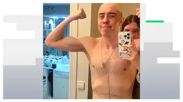 El triatleta que desafía lo imposible: Javier Corrales compite tras perder el 80% de su estómago El triatleta que desafía lo imposible: Javier Corrales compite tras perder el 80% de su estómago