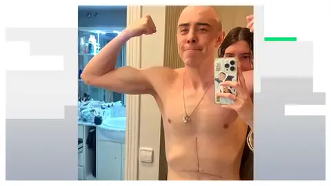 El triatleta que desafía lo imposible: Javier Corrales compite tras perder el 80% de su estómago El triatleta que desafía lo imposible: Javier Corrales compite tras perder el 80% de su estómago