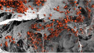 Imagen de microscop&iacute;a electronica ilustrando el modelo de m&eacute;dula &oacute;sea humana generado en el laboratorio colonizado por c&eacute;lulas sangu&iacute;neas en rojo. 