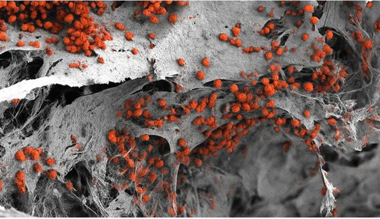 Imagen de microscopía electronica ilustrando el modelo de médula ósea humana generado en el laboratorio colonizado por células sanguíneas en rojo.