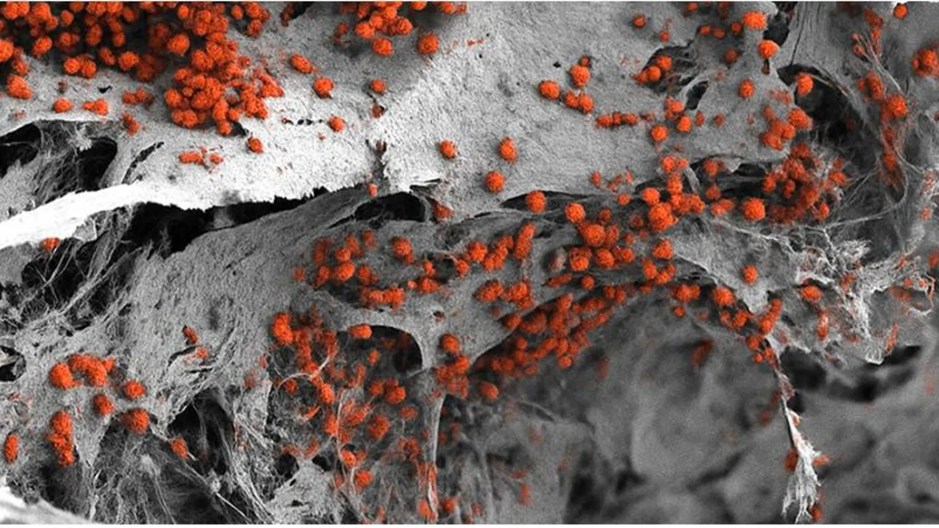 Imagen de microscopía electronica ilustrando el modelo de médula ósea humana generado en el laboratorio colonizado por células sanguíneas en rojo. Imagen de microscopía electronica ilustrando el modelo de médula ósea humana generado en el laboratorio colonizado por células sanguíneas en rojo.