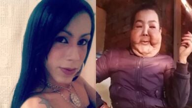 La influencer brasileña Juju do Pix inicia su reconstrucción facial tras las secuelas de una cirugía clandestina en 2017