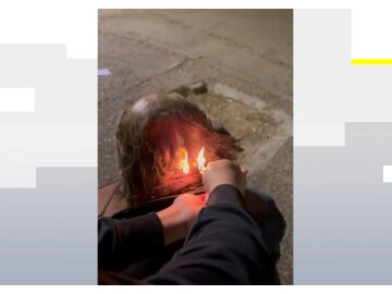 Le queman el pelo a una persona sin hogar