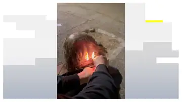 Le queman el pelo a una persona sin hogar Le queman el pelo a una persona sin hogar
