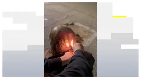 Le queman el pelo a una persona sin hogar Le queman el pelo a una persona sin hogar
