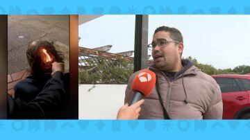 Amigo sintecho quemado por menores