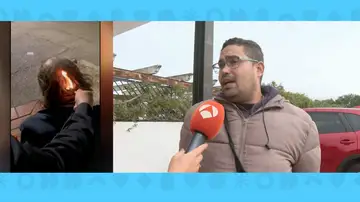 Amigo sintecho quemado por menores Amigo sintecho quemado por menores