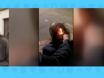 Sintecho agredido Sintecho agredido