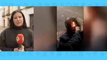 Sintecho agredido Sintecho agredido