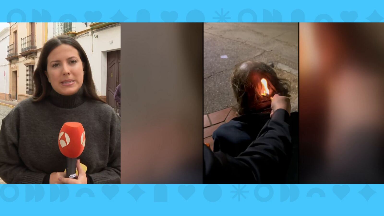 Localizan al sintecho al que dos menores quemaron en repetidas ocasiones: 