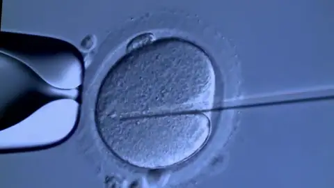 35 de los 197 bebés que engendró un donante de esperma con un gen cancerígeno 35 de los 197 bebés que engendró un donante de esperma con un gen cancerígeno