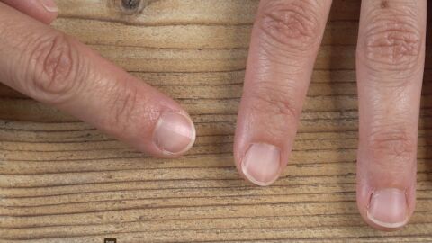 ¿Tienes surcos verticales u horizontales en las uñas? Estos son los motivos por los que aparecen
