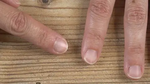 ¿Tienes surcos verticales u horizontales en las uñas? Estos son los motivos por los que aparecen ¿Tienes surcos verticales u horizontales en las uñas? Estos son los motivos por los que aparecen