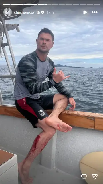 Chris Hemsworth herido en una pierna durante sus vacaciones de Navidad Chris Hemsworth herido en una pierna durante sus vacaciones de Navidad