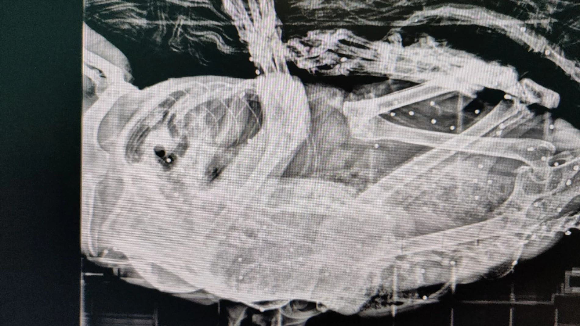 Hallan un gato con más de 50 disparos de perdigones en su cuerpo en Polanco Hallan un gato con más de 50 disparos de perdigones en su cuerpo en Polanco