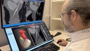 Imagen de archivo de una tomograf&iacute;a