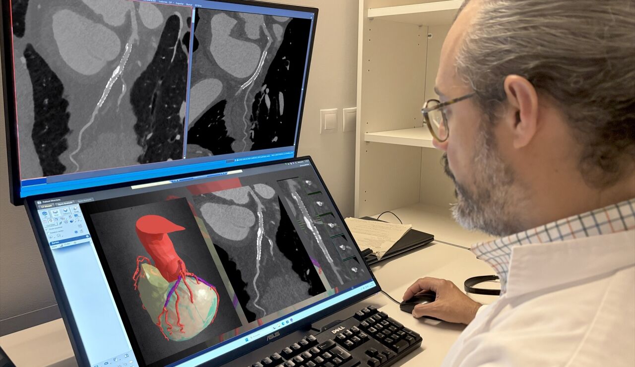 Imagen de archivo de una tomograf&iacute;a