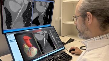 Imagen de archivo de una tomograf&iacute;a