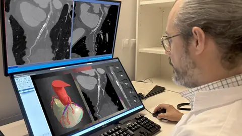 Imagen de archivo de una tomografía Imagen de archivo de una tomografía