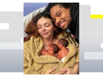 La cantante Jesy Nelson revela que sus hijas padecen una grave enfermedad: "Nunca podr&aacute;n caminar"