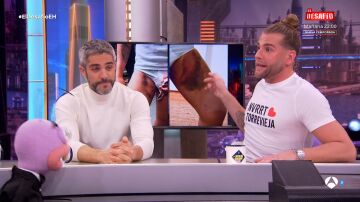 Lo &uacute;nico que Eduardo Navarrete cambiar&iacute;a de su paso por El Desaf&iacute;o: "Casi pierdo un huevo"