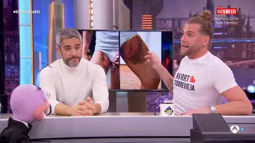 Lo único que Eduardo Navarrete cambiaría de su paso por El Desafío: "Casi pierdo un huevo" Lo único que Eduardo Navarrete cambiaría de su paso por El Desafío: "Casi pierdo un huevo"