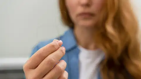 Mujer que sufre de caída de pelo Mujer que sufre de caída de pelo