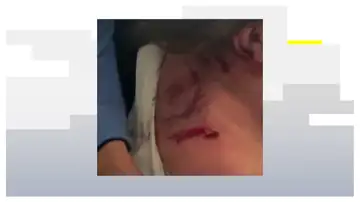 Las heridas en la espalda Las heridas en la espalda