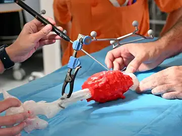 Salvan la pierna a un niño con un tumor óseo gracias a la tecnología 3D Salvan la pierna a un niño con un tumor óseo gracias a la tecnología 3D